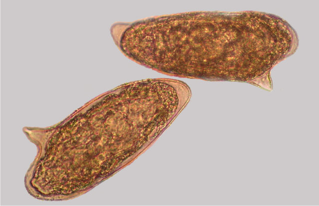 schistosoma mansoni eggs