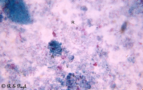 Retortamonas intestinalis 1 03.jpg